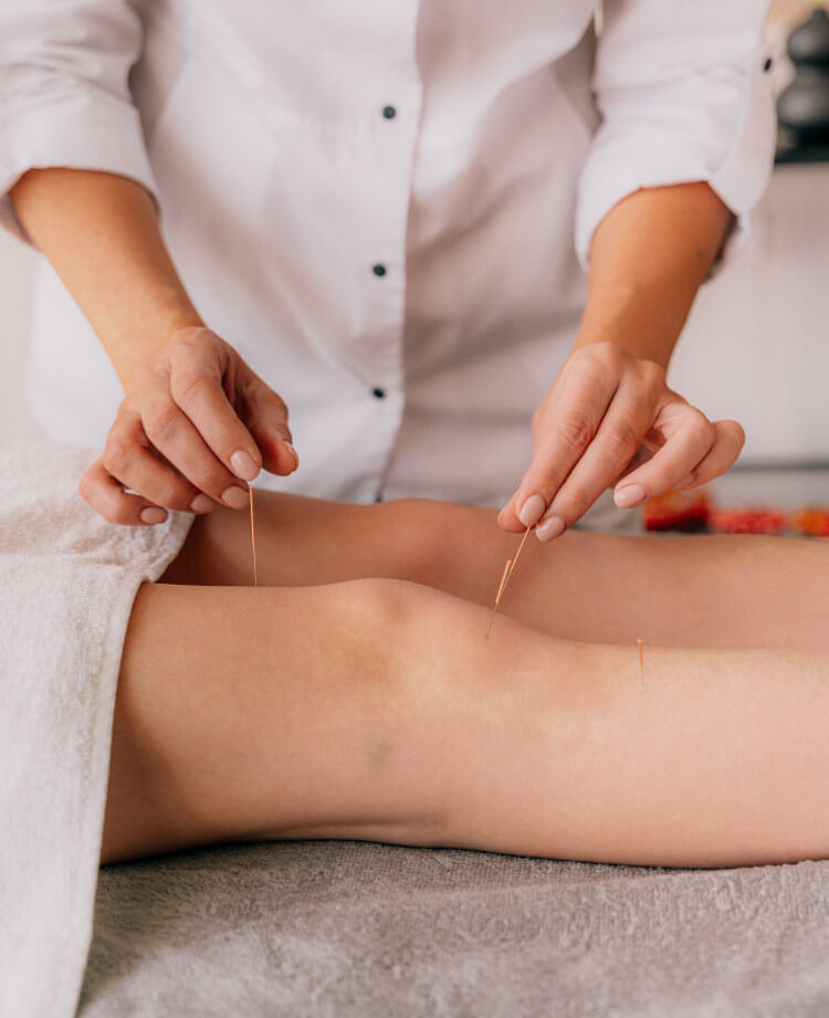 tips for choosing an acupuncturist