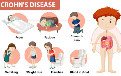 Autoimmune Disease: Causes, Types and Symptoms