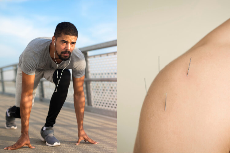 acupuncture for athletes