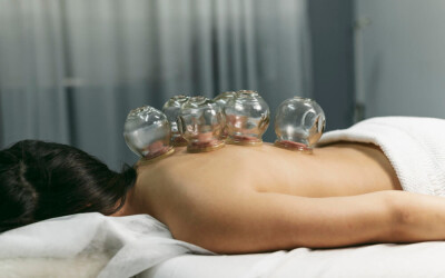 Acupuncture and Cupping as Effective Alternatives for Chronic Pain