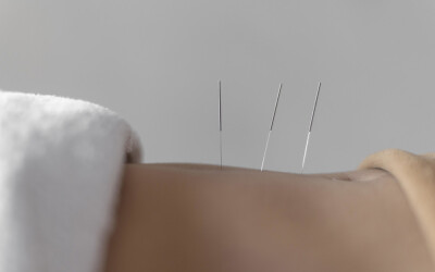 Enhancing Cancer Care: The Role of Acupuncture in Integrative Oncology