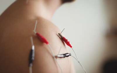 Electro-Acupuncture: Merging Ancient Wisdom with Modern Technology for Holistic Healing