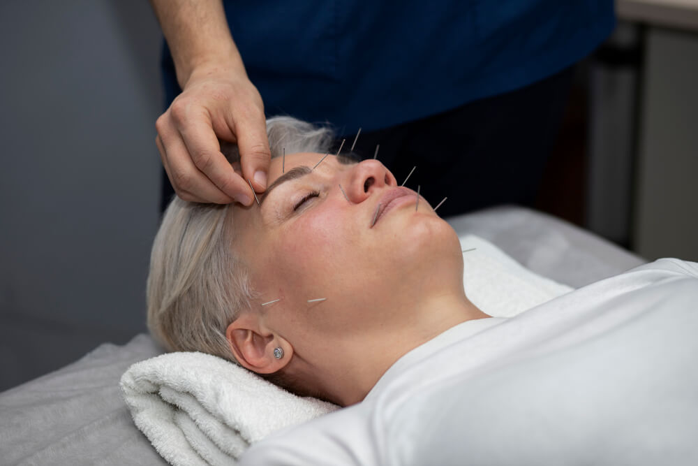 facial acupuncture discover radiant beauty holistic well-being