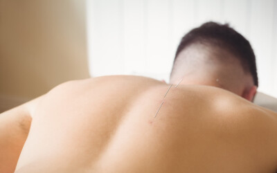 Acupuncture for Hormone Balance