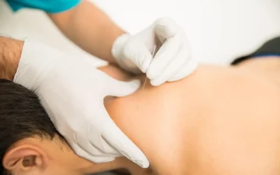 How Acupuncture Calms the Cough Reflex and Soothes Airway Inflammation