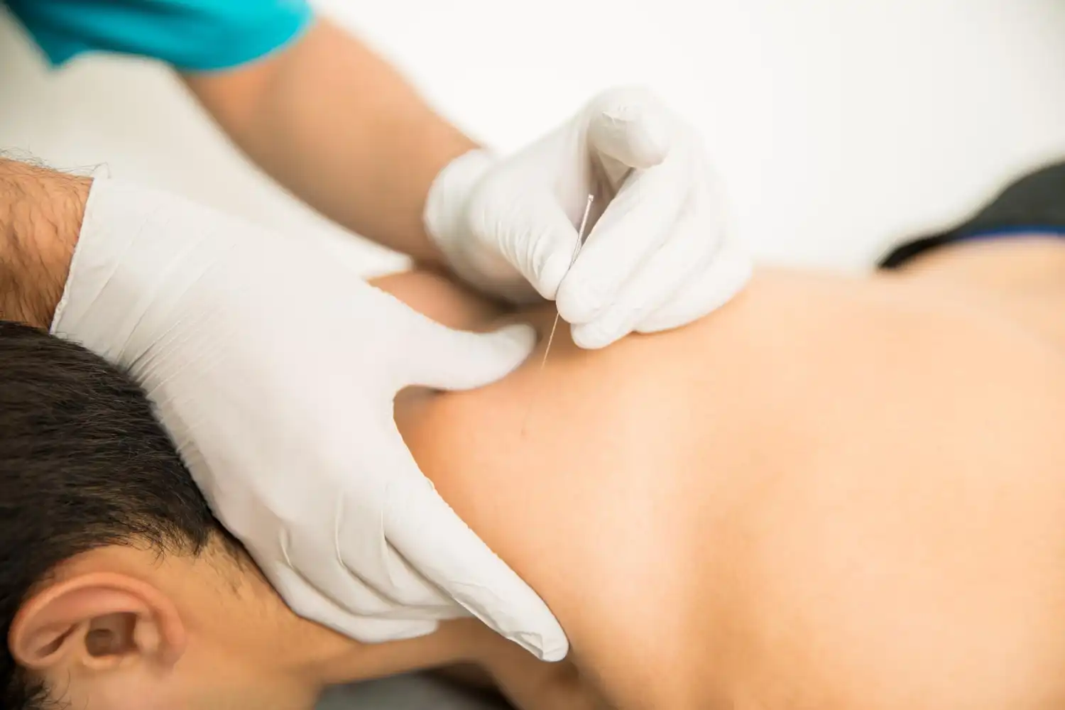 acupuncture calms the cough reflex