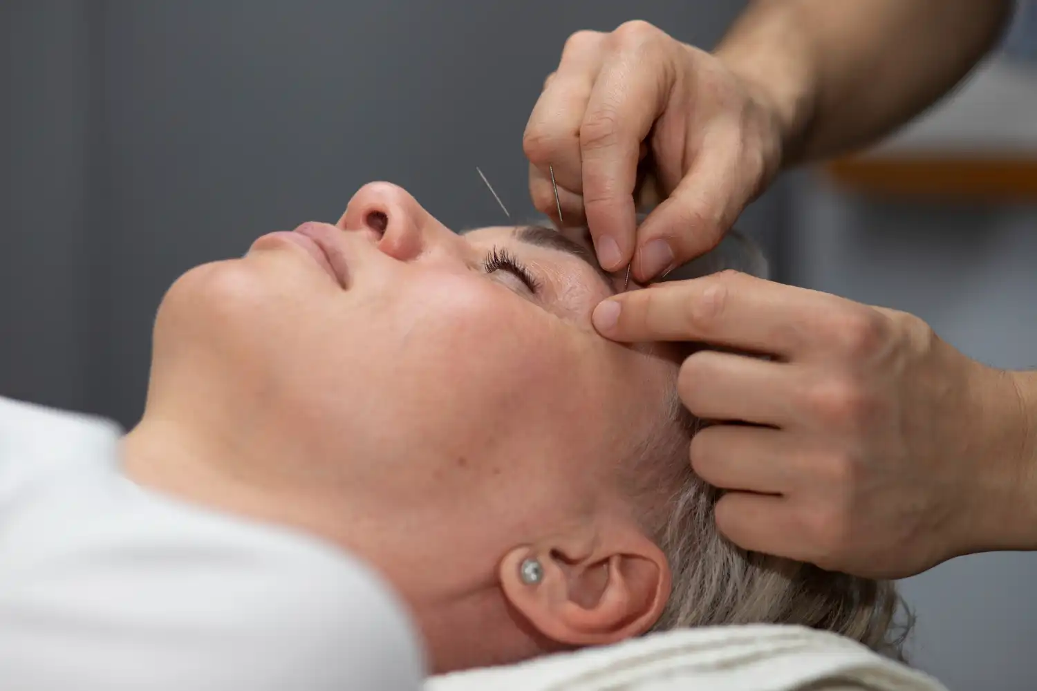 acupuncture for long covid sufferers