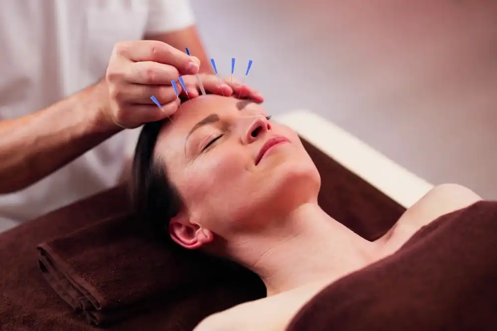 acupuncture for long covid